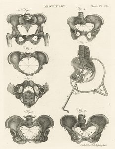 Midwifery, illustration from 